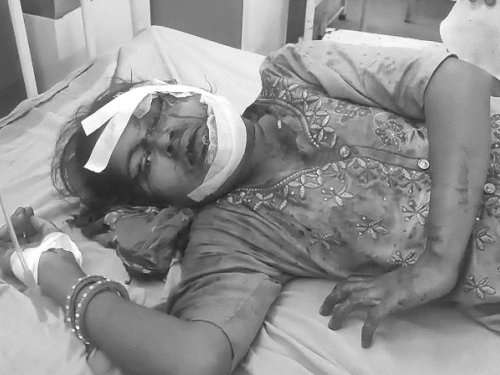 अलवर में दामाद ने सोते समय की सास की हत्या:आधी रात को ससुराल पहुंचा नशे में धुत आरोपी; रॉड से ताबड़तोड़ हमला किया 1 gif 63 2 1749981374 DsLLzU